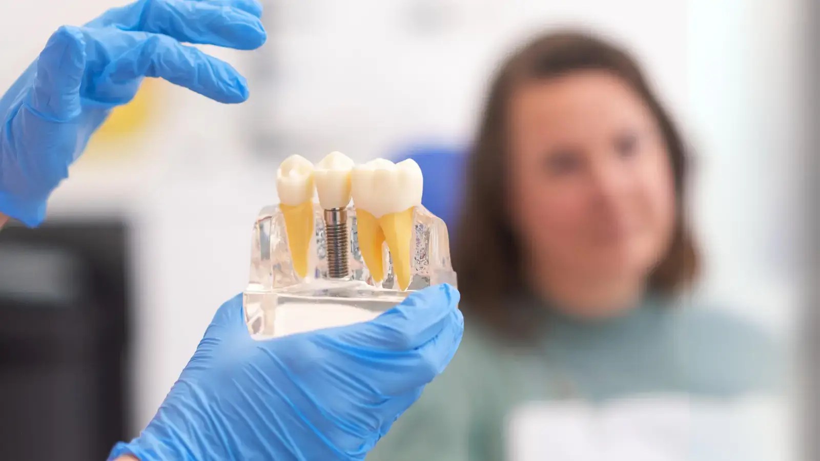 Mastering Dental Implants