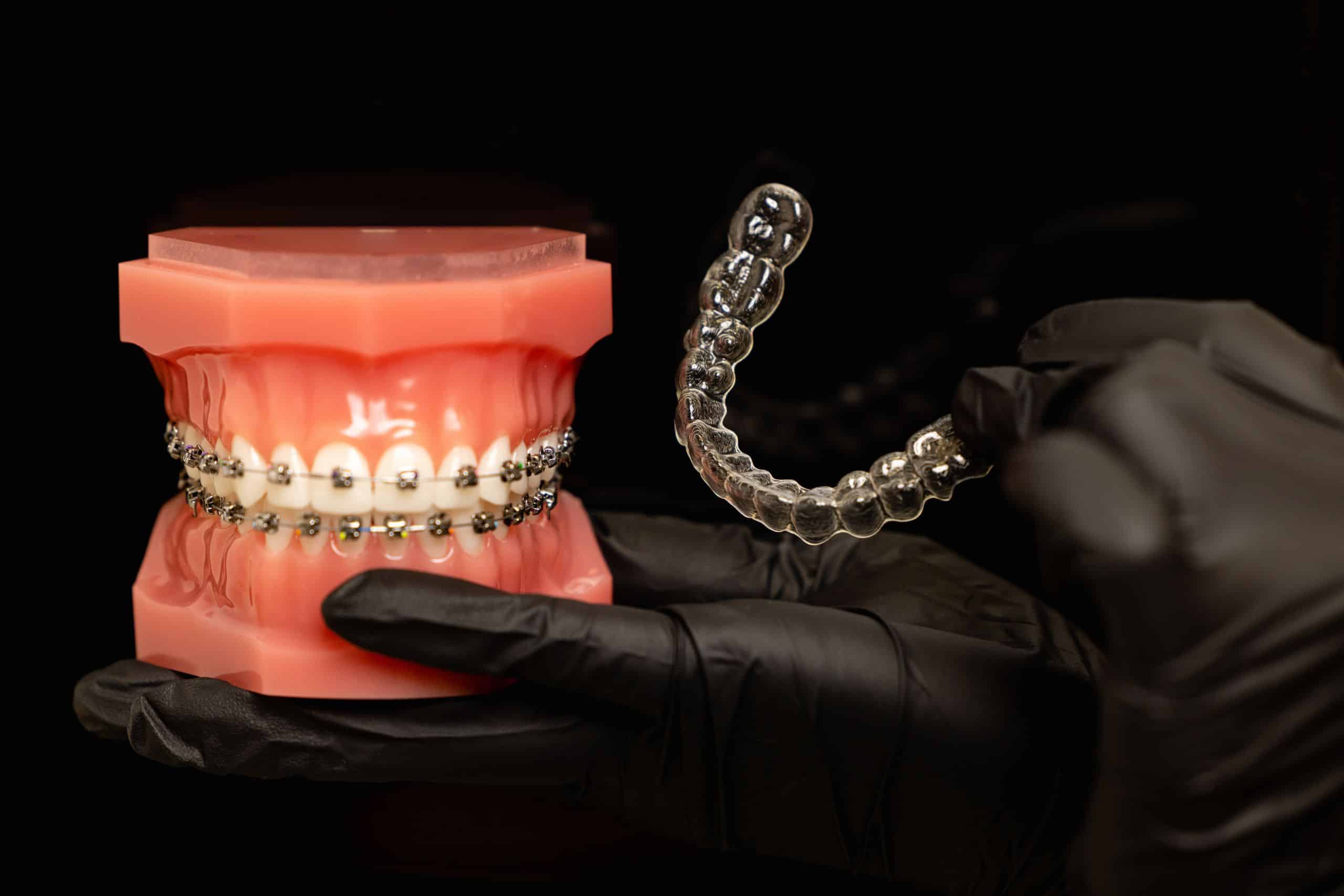 Image showing the difference whether a patient requires traditional braces or invisalign