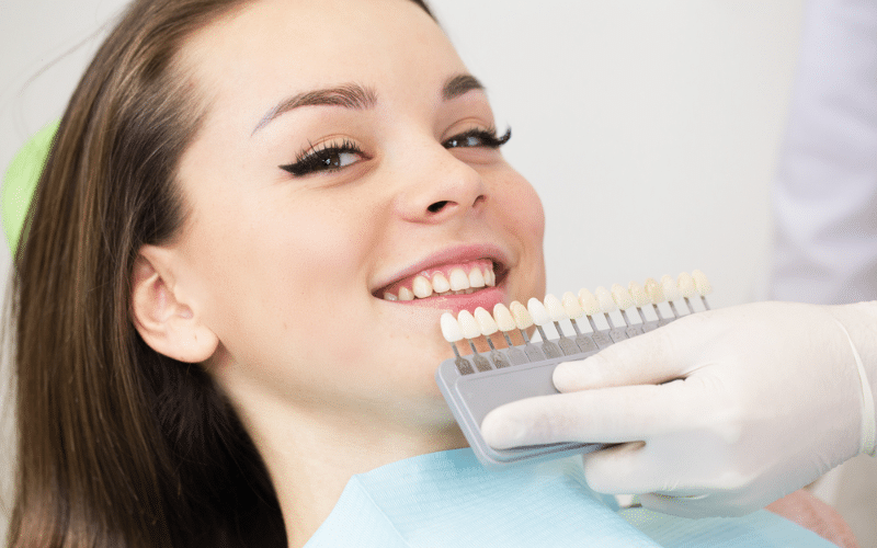 The Process: How Veneers Repair Chipped or Broken Teeth