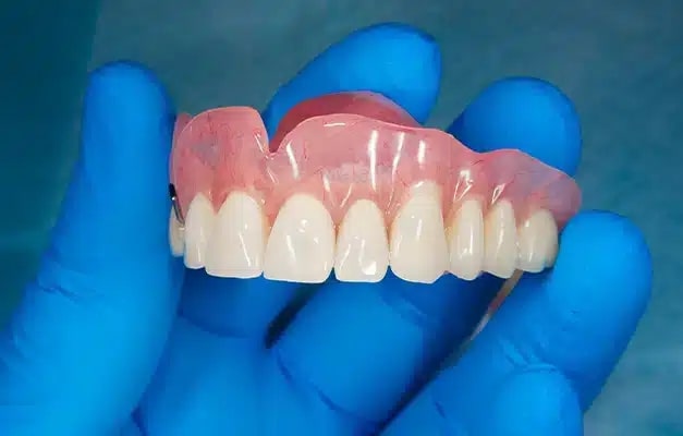 Dentures made by Darley Dental Care at Altamonte Springs